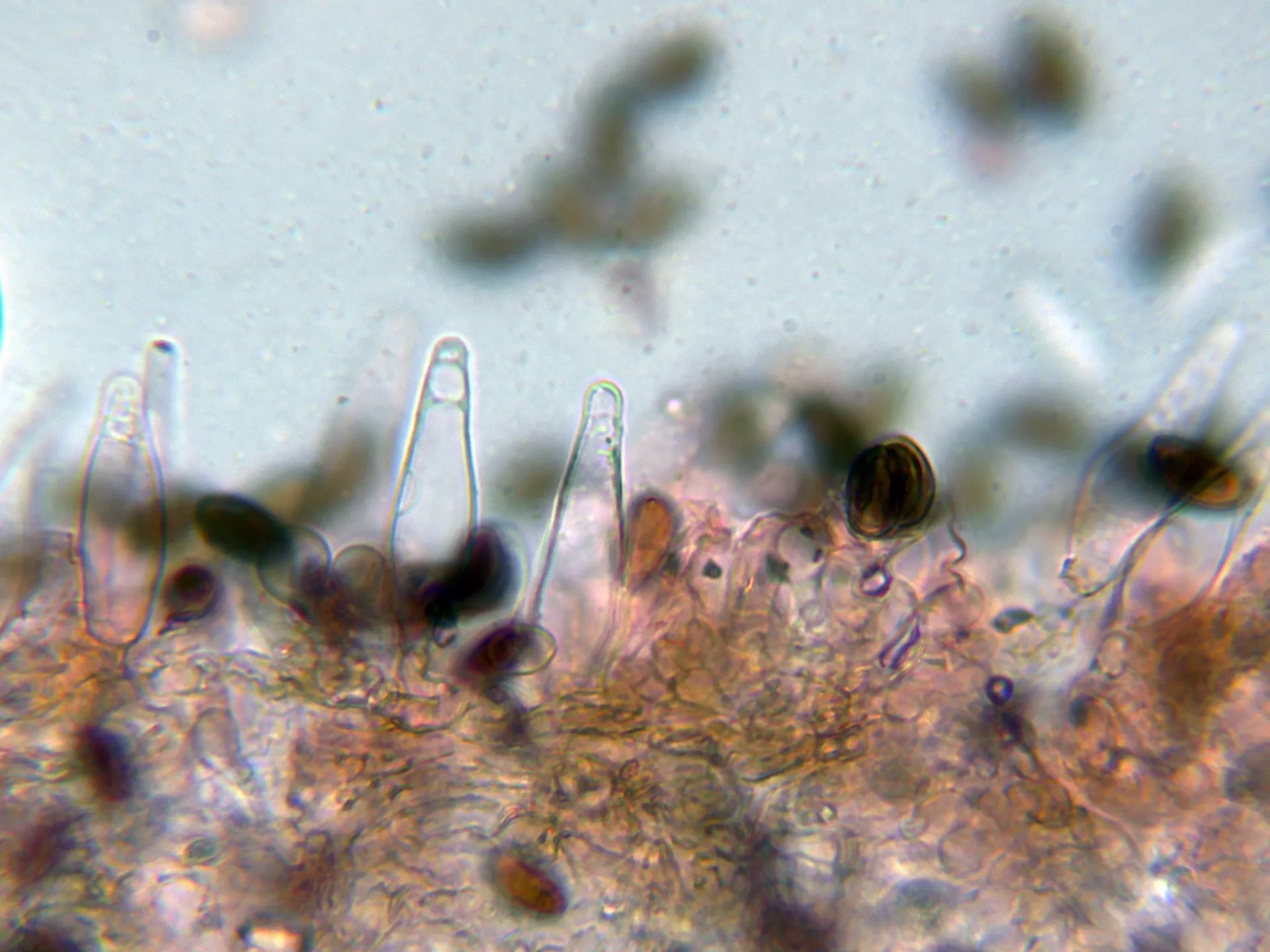 Microscopía de Psathyrella corrugis - 10 - Queilocistidio-009